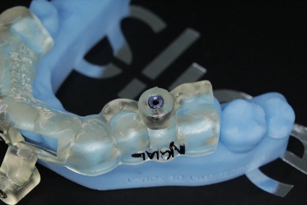 Guia impresso em 3D com a anilha metálica para a remoção do pino
